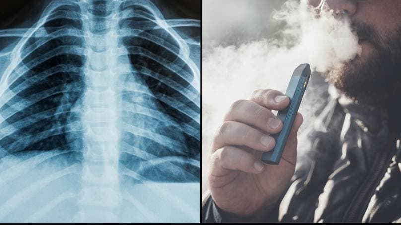 Lëshohet një paralajmërim për konsumuesit e cigareve me avull