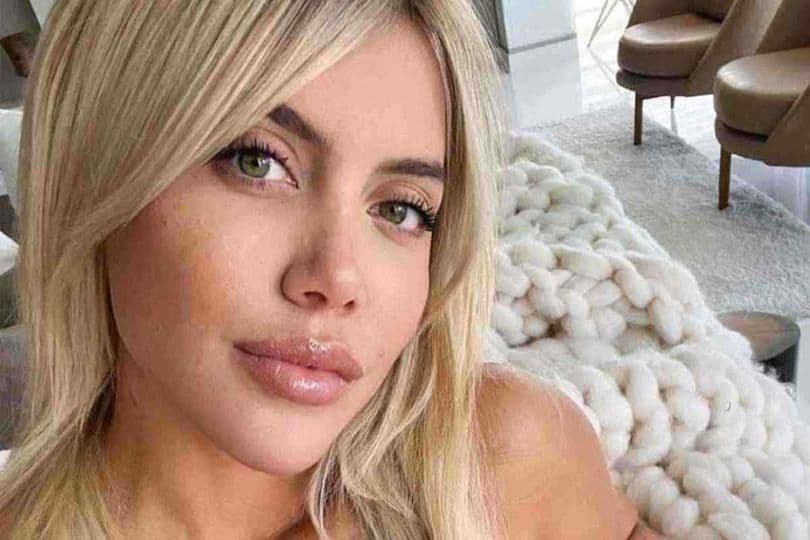 Dyshohet se u diagnostikua me leukemi – Wanda Nara flet për gjendjen e saj shëndetësore