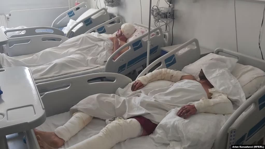 Mungesa e qendrës për djegie mbingarkon Kirurgjinë Plastike
