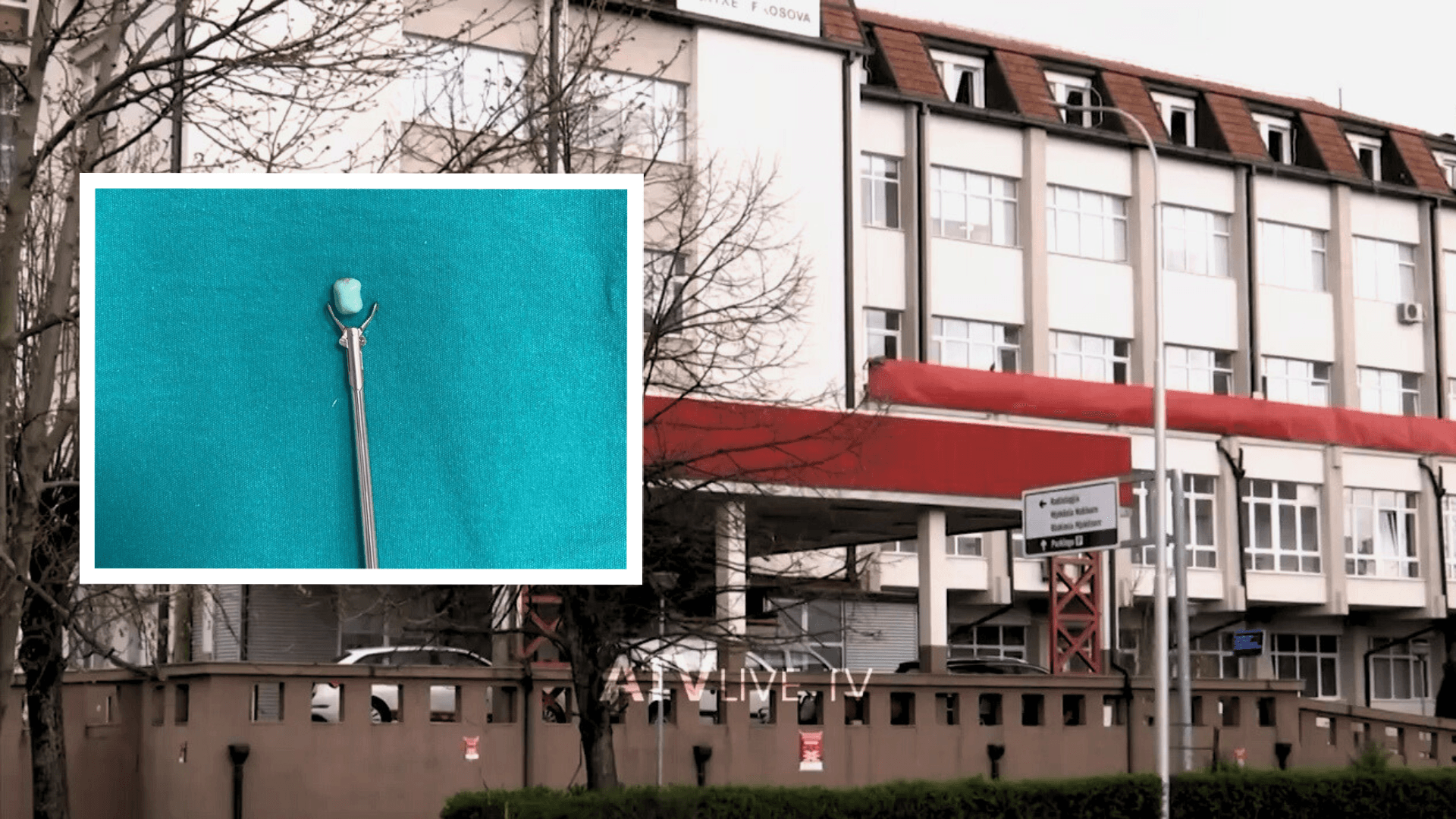 Mjekët në QKUK i shpëtojnë jetën fëmijës 1-vjeçar, kishte gëlltitur një pjesë të lodrës
