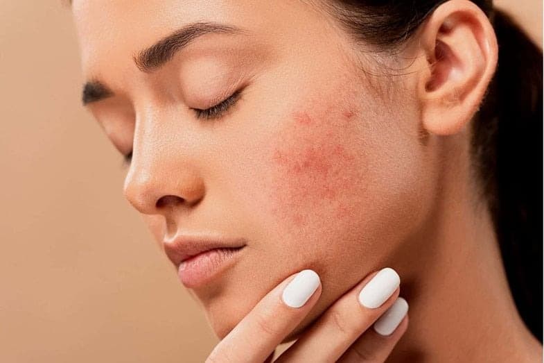 Shenjat e çrregullimeve hormonale që nuk duhen injoruar