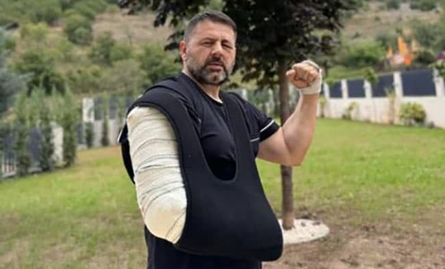 Deputeti Bekë Berisha shfaqet me krah të thyer pas aksidentit, tregon për momentet e para pas përplasjes