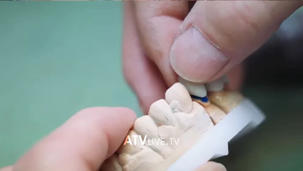 20 Marsi, dita ndërkombëtare e shëndetit oral dhe dentar
