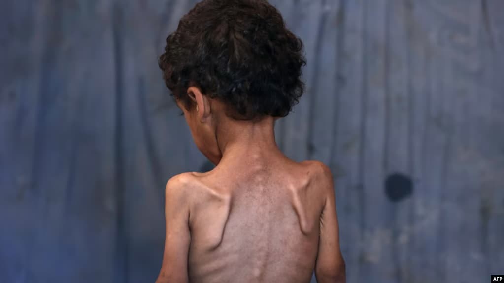 Ekspertët e krizave ushqimore: Skenari më i keq i urisë po ndodh në Gaza