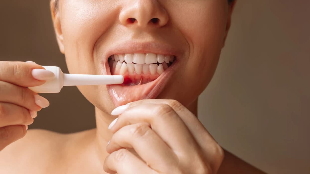 Dieta që forcon mishrat e dhëmbëve dhe ndalon inflamacionin – shkencëtarët befasohen nga rezultatet