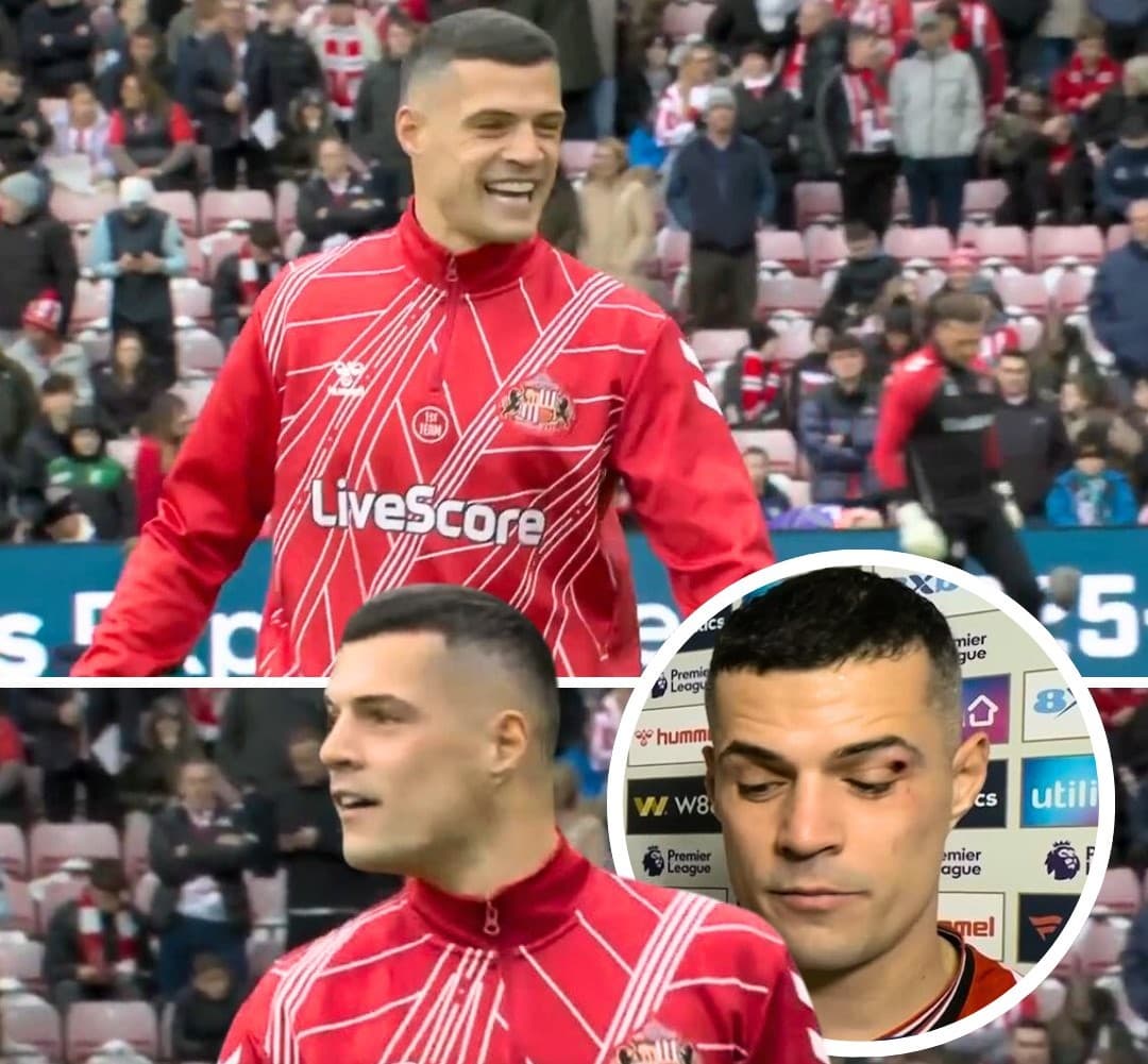 Xhaka: “Derbit janë për t’u fituar, ekipi e meriton suksesin”