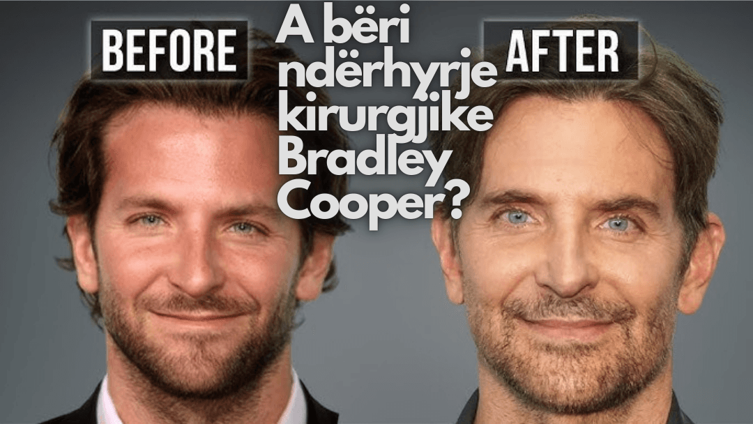 DR. TERRY DUBROW SHPËRTHEN: “MBYLLENI GOJEN PËR OPERACIONIN E BRADLEY COOPER!!!”