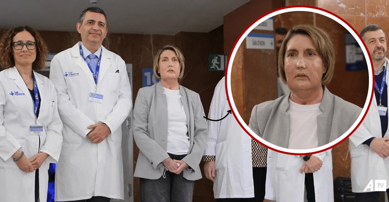 Spanja realizon transplantin e parë të fytyrës në botë