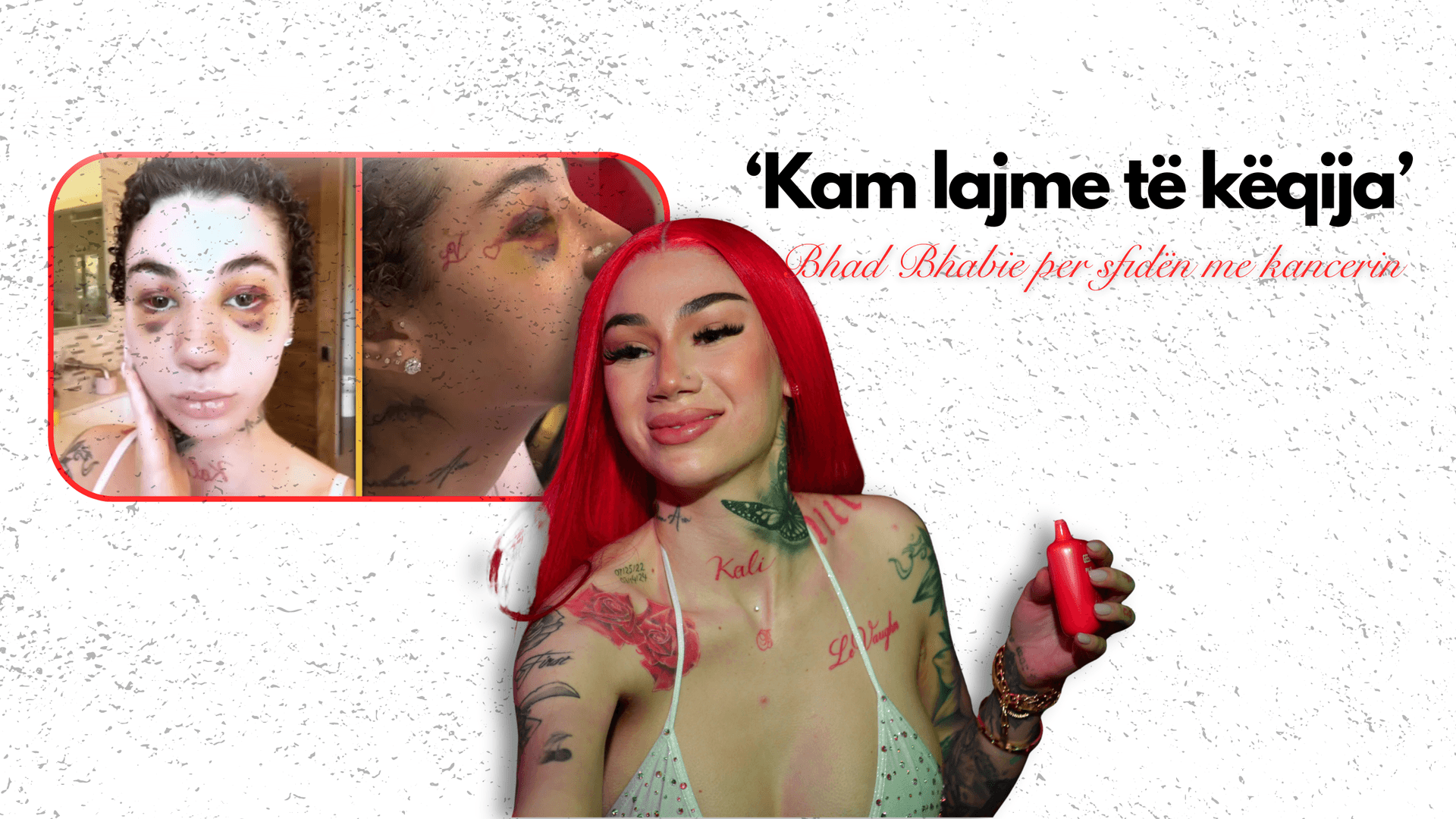 Bhad Bhabie flet për përditësimin nga mjeku mes betejës me kancerin!