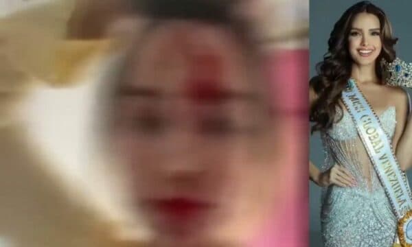 Fytyra e mbuluar me gjak, dhunohet “Miss Venezuela”, arrestohet stilisti i njohur