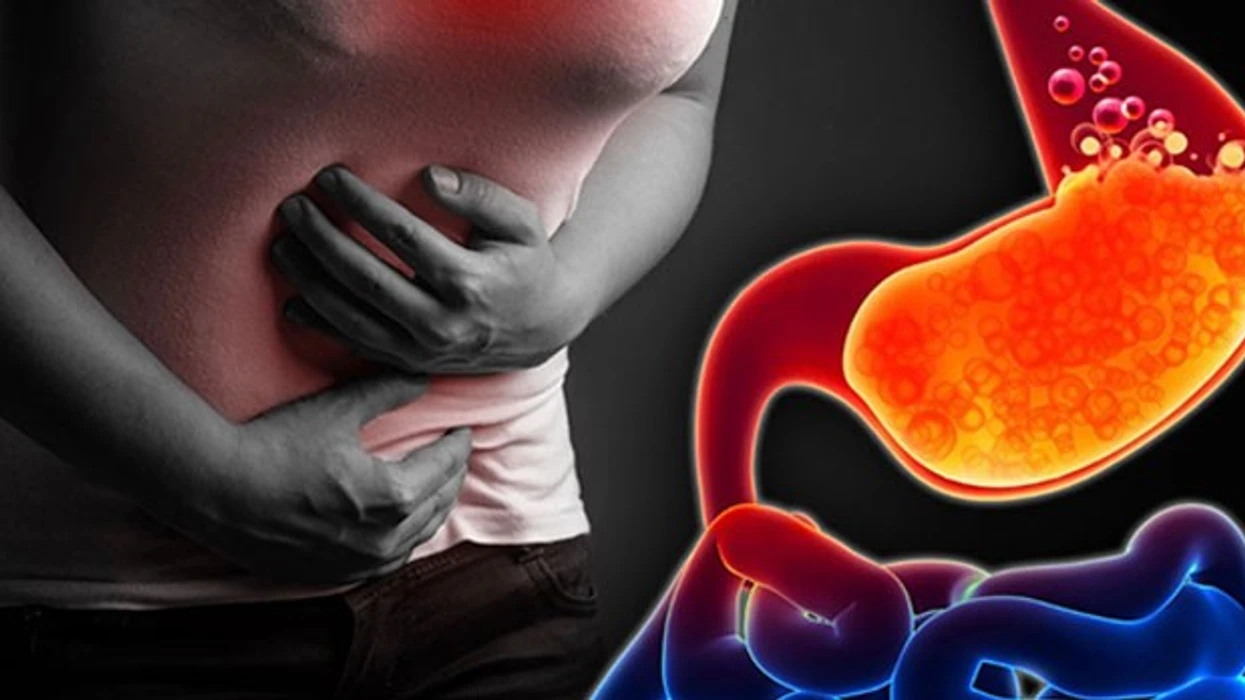 semundjet-me-te-shpeshta-te-stomakut-infeksione-apo-crregullime-qe-ndikojne-ne-tretje