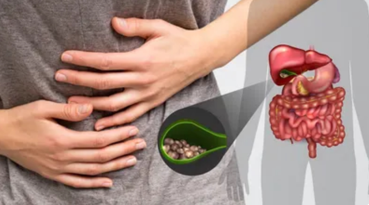 Cilat ushqime duhet t i shmangin personat me gurë në tëmth 