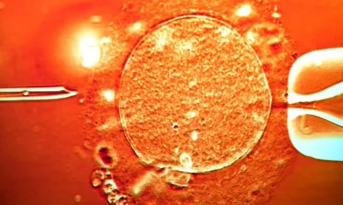 Sperma nga donatori me gjen që shkakton kancer u përdor për të ngjizur pothuajse 200 fëmijë nëpër Evropë