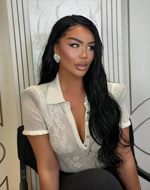 Bafte Shala flet për botoksin   S ka pas rëndësi kurrë se çfarë thonë të tjerët 