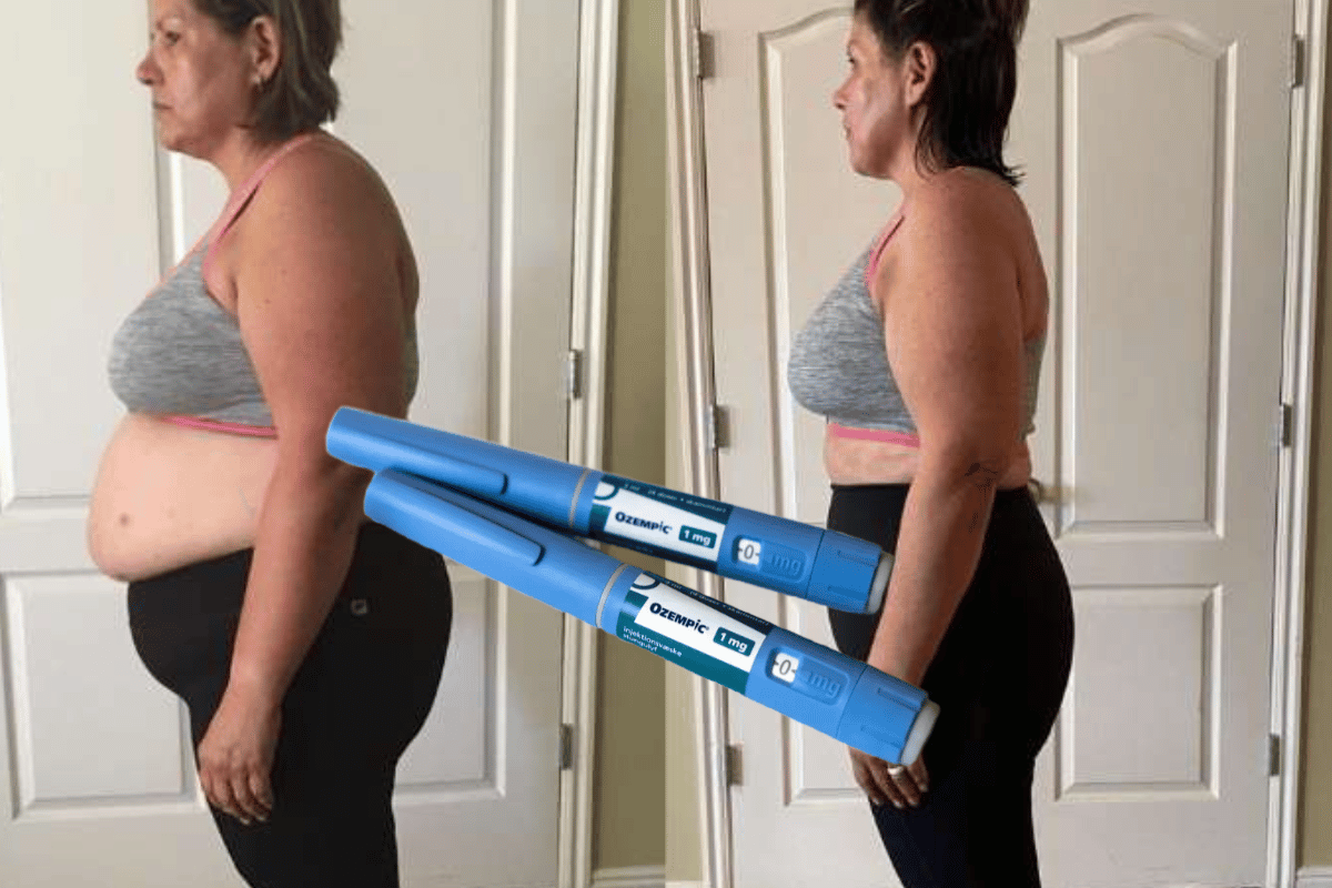 nderprerja-e-injeksioneve-per-humbje-peshe-con-ne-rifitimin-e-peshes