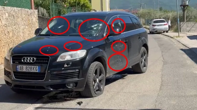  Për arsye hakmarrjeje   policia zbulon motivet e atentatit ndaj çiftit në Lezhë
